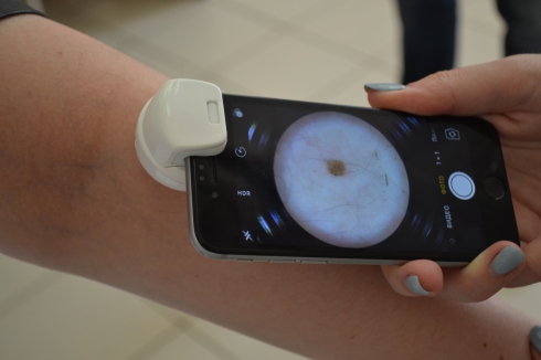Девушка из Екатеринбурга запатентовала и создала мобильное приложение, которое по родинкам на теле может выявить онкологию