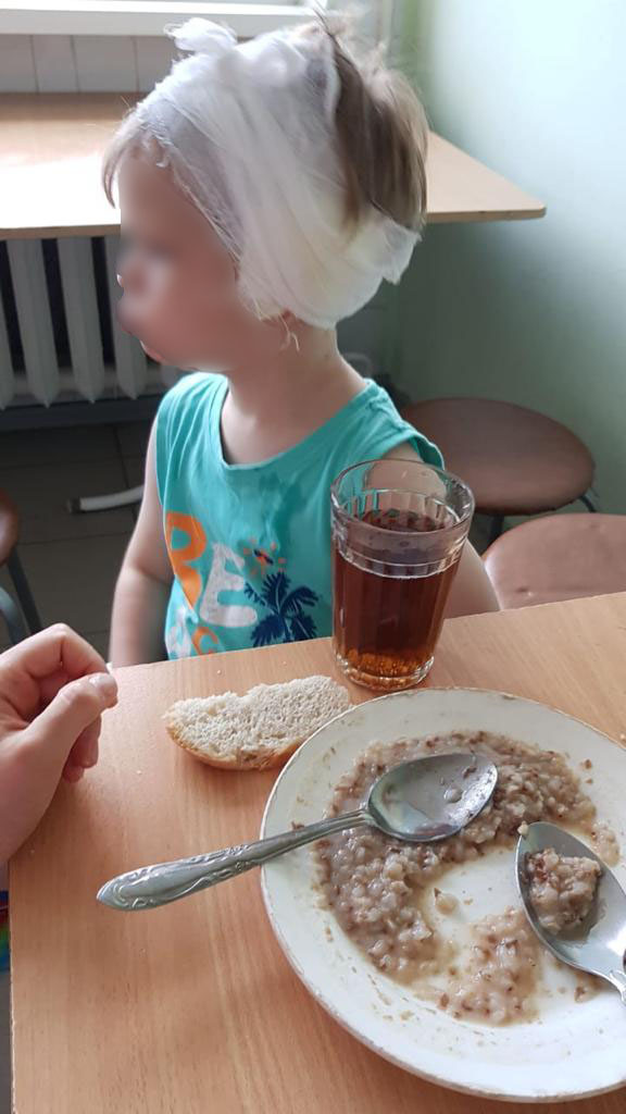Двухлетний ребенок в Екатеринбурге во время прогулки в детсаду насквозь проткнул ушную раковину